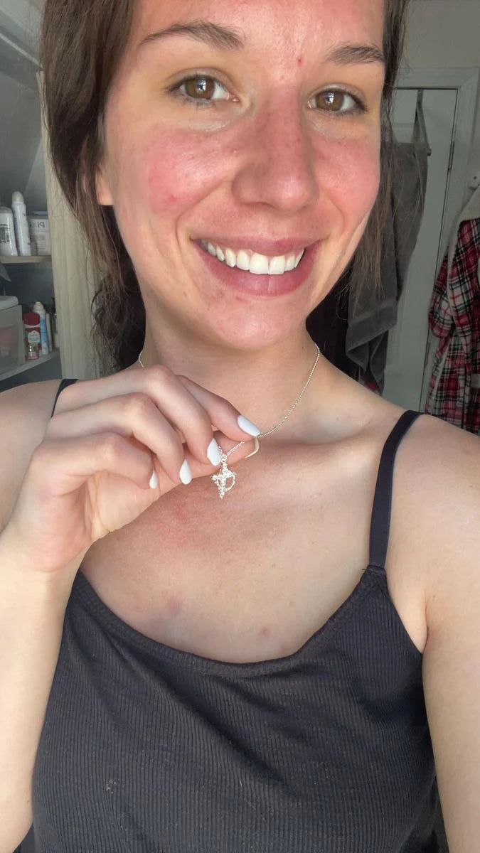 <p>❤️ Elegido con amor por más de 3,000 corazones que sienten como tú</p>
